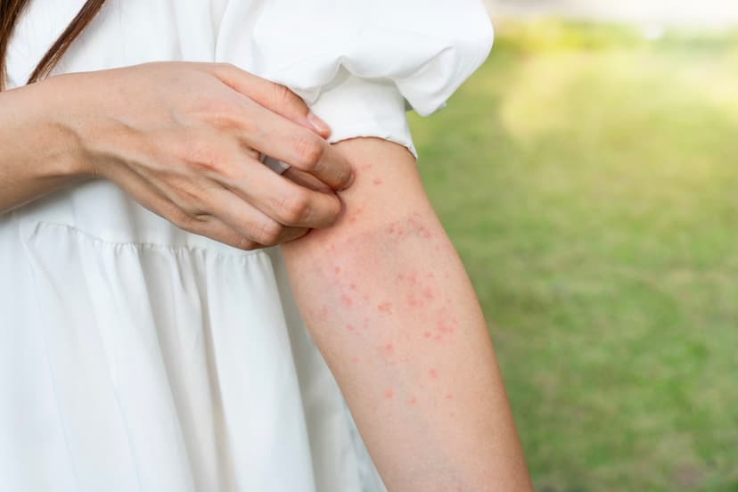Bite, Bump, or Breakout? How to Tell What’s Really Bugging Your Skin